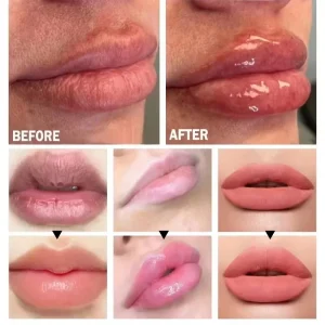 Lip Plumper - Thumbnail Image 2